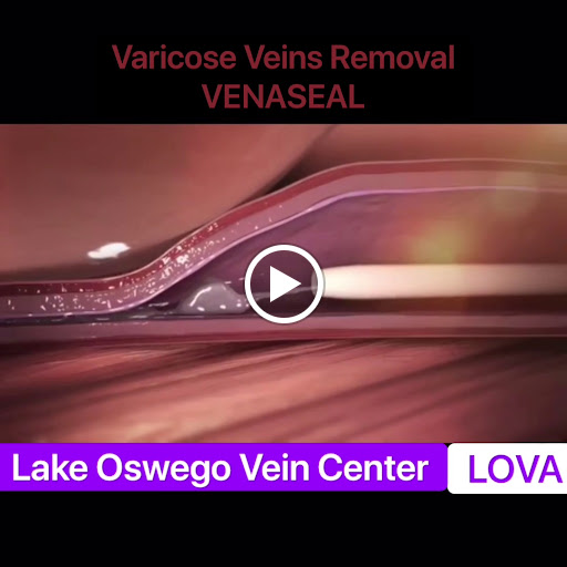 Explore link tattoo ideas, creative tattoo ideas in Lake Oswego, available at Lake Oswego Vein and Aesthetic LOVA