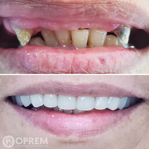 Oprem Dental Clínica odontológica especializada / Dra. Maria Molina / Dra. Karen Bustos