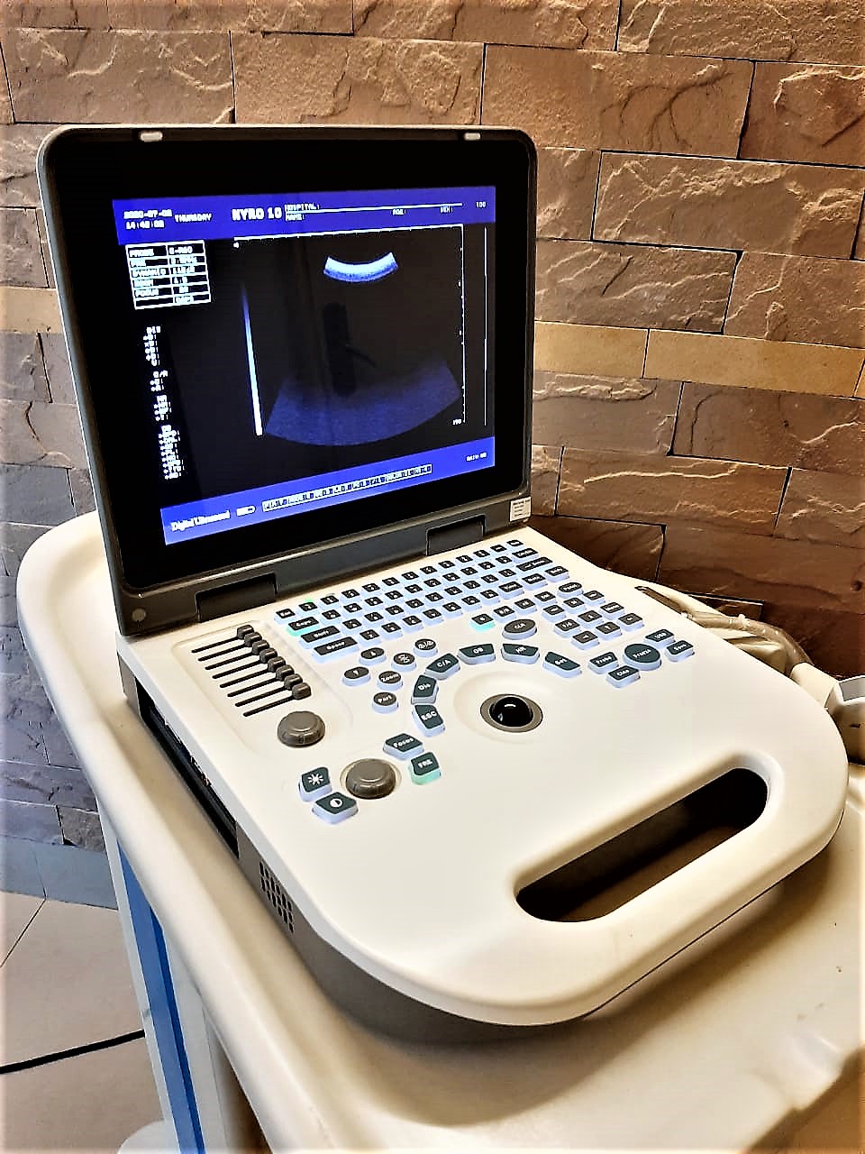 Sonotech Leading importers of Color Doppler & Ultrasound machines. All about Ultrasound