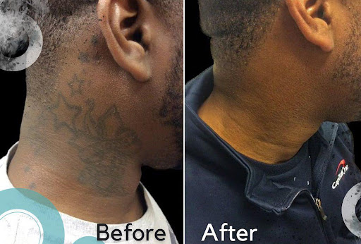 Explore boston sports tattoo ideas, creative tattoo ideas in Glen Mills, available at Removery Tattoo Removal & Fading