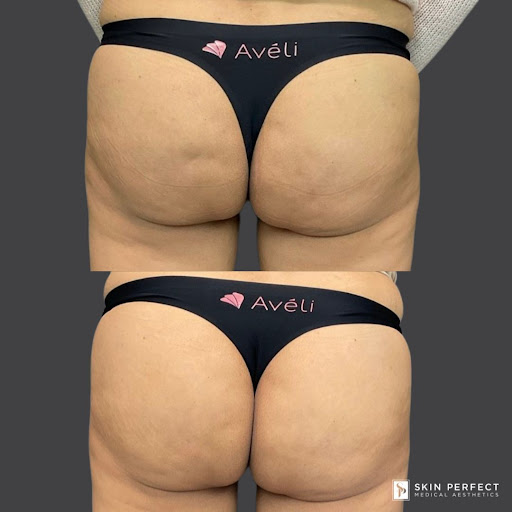 Explore infinity tattoo ideas for men, creative tattoo ideas in Whittier, available at Skin Perfect Medical Aesthetics