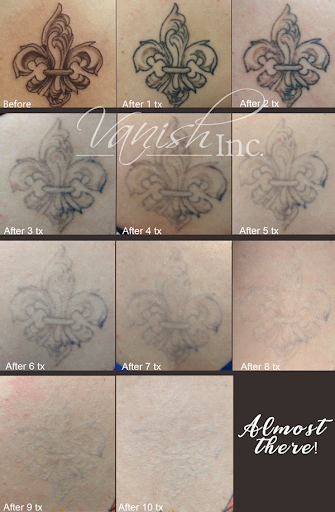 Explore horizon zero dawn tattoo ideas, creative tattoo ideas in Williamsport, available at Vanish Laser & Skin, Inc.