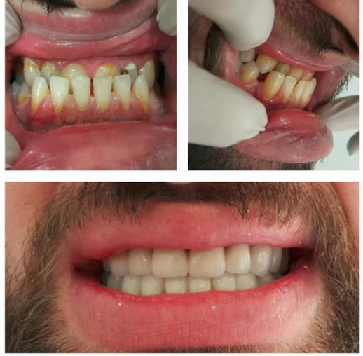 DentMarmaris Dental Clinic & Dental Laboratory - DentMarmaris Dental Clinic & Dental Laboratory