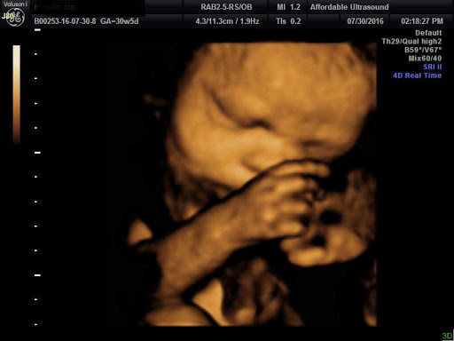 5d ultrasounds in Houston