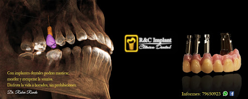 R&C Implant Clinica Dental