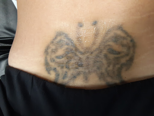 Explore laugh now cry later tattoo ideas, creative tattoo ideas in Saint Paul, available at Fearless Tattoo Removal