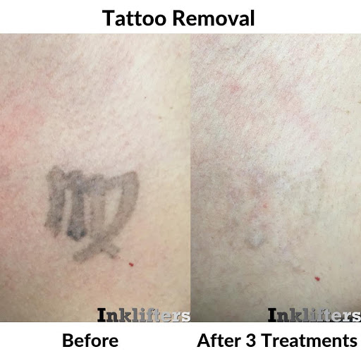 Explore mexican tattoo ideas, creative tattoo ideas in Pleasant Grove, available at Inklifters Tattoo Removal