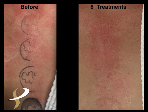 Explore german shepherd tattoo ideas, creative tattoo ideas in Spokane, available at Premier Body and Laser