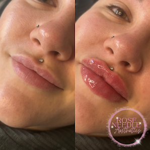 RoseNeedleAesthetics 