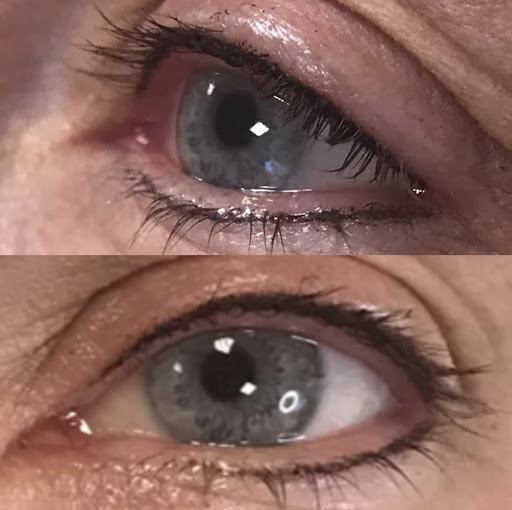 Permanent Eyeliner