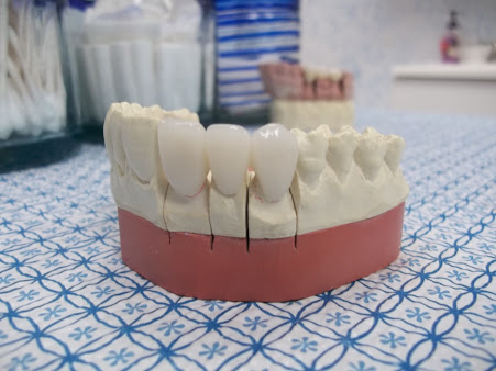 CAD/CAM Cosmetic Technology, Dental Artistry Dental Center - CAD/CAM Cosmetic Technology, Dental Artistry Dental Center