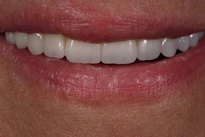 Dental Aesthetics Athens – Δρ. Ε. Παπαδιώτης Οδοντίατρος image