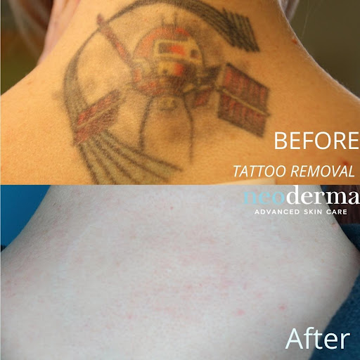 Explore toy story tattoo ideas, creative tattoo ideas in Anaheim, available at Neoderma