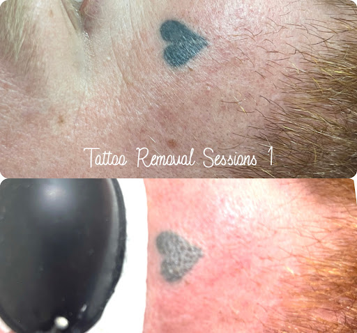 Explore arm blackout tattoo ideas, creative tattoo ideas in Savannah, available at Haute Brows. Cosmetic Tattoo