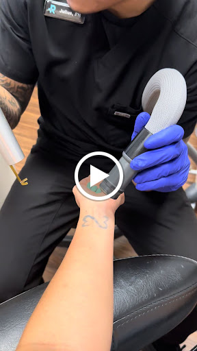 Explore cover up tattoo ideas on thigh, creative tattoo ideas in Santa Ana, available at Removery Tattoo Removal & Fading