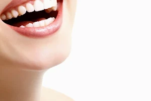 Dr Vivek Goyal Dental Clinic best dental treatment image