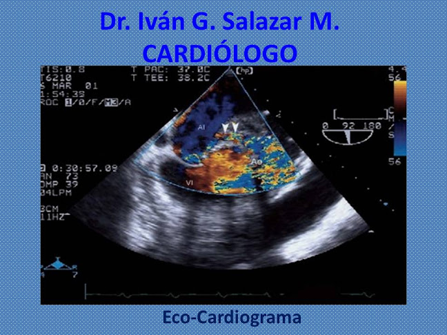 Opiniones de Dr. Ivan G. Salazar M. en Ibarra - Médico