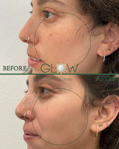 Glow Aesthetic Center Encino image