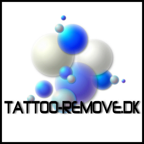 tattoo-remove.dk