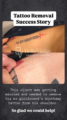 Explore snorlax tattoo ideas, creative tattoo ideas in Lakeland, available at Bella Visge Medical & Aesthetic Rejuvenation