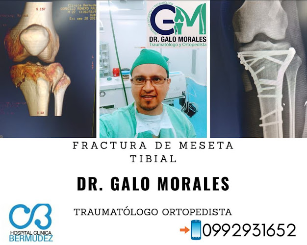 Opiniones de Traumatologia Dr. Galo Morales en Santo Domingo de los Colorados - Médico