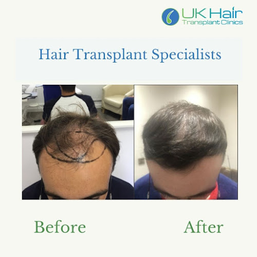 UK Hair Transplant Clinics - Doctor