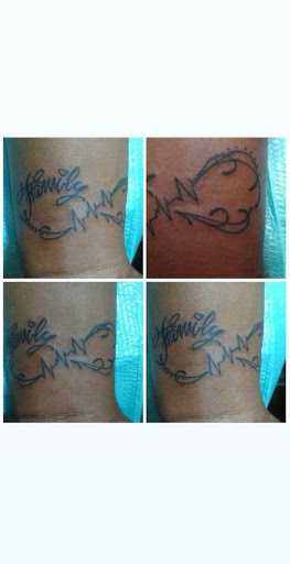 Explore tattoo over scar ideas, creative tattoo ideas in Hialeah, available at Allstar Tattoo & Body piercing