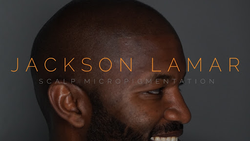 Jackson Lamar Scalp Micropigmentation Dallas