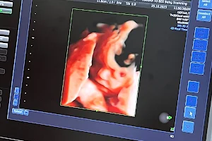 Mamma To Bee Baby Scanning & Gender Reveals image