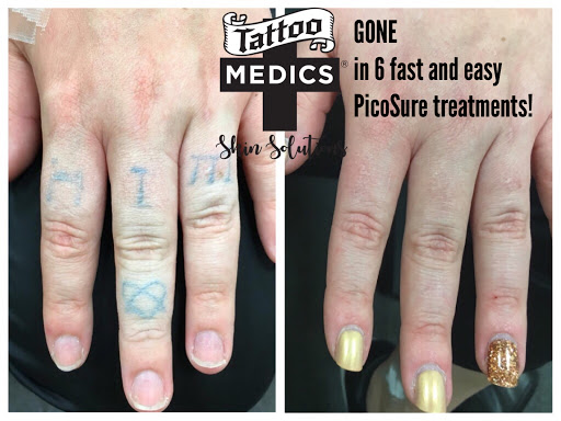 Explore cool leg tattoo ideas, creative tattoo ideas in Providence, available at TattooMedics Laser Tattoo Removal