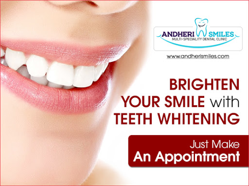 Andheri Smiles Dental Clinic Mumbai