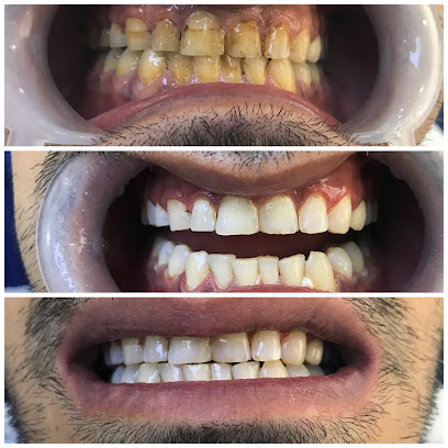 AKIN PEKİNCE Diş Kliniği-Elazığ