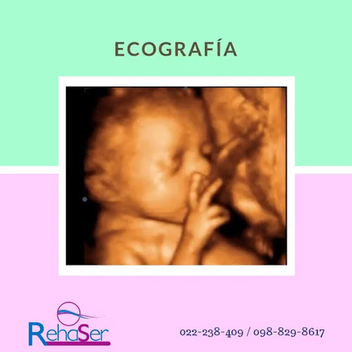 RehaSer Ecografia 3D 4D Eco Doppler Rayos X a Domicilio Traumatología Fisioterapia Histerosalpingografia Histerosonografia - Quito