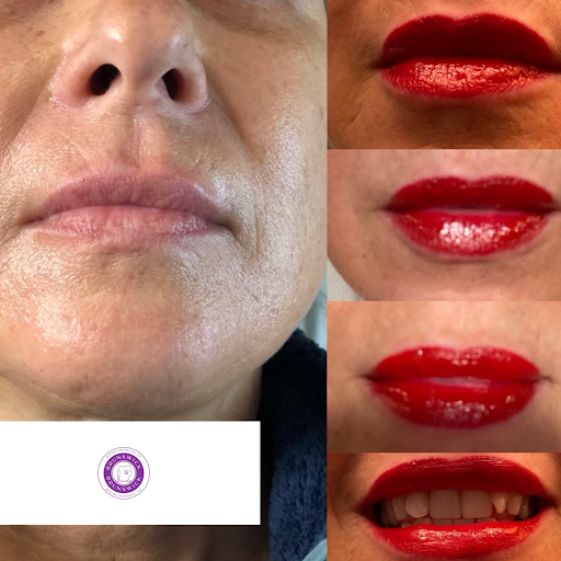 Find clouds tattoo ideas for your next unique tattoo in Brunswick at Brunswick Medical Aesthetics