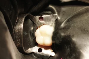 dentista Dent de loup ecatepec image