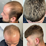 The Hair Tattoo Clinic - Scalp Micropigmentation & Hair Systems