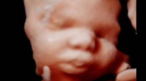 Forever Yours HD 3D/4D Ultrasound