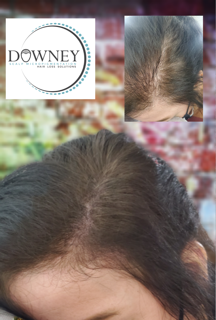 Downey Hair Loss Solutions SMP 90650