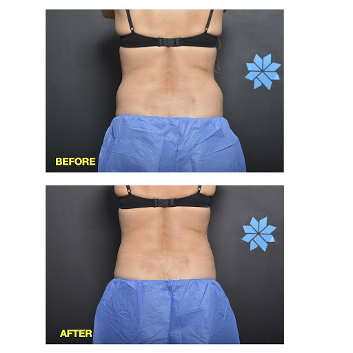 Explore gengar tattoo ideas, creative tattoo ideas in Chino, available at SoCal Body Institute