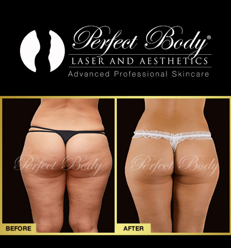 Explore code geass tattoo ideas, creative tattoo ideas in Bay Shore, available at Perfect Body Laser & Aesthetics