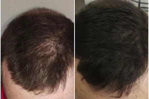 The Hair Loss Clinic image