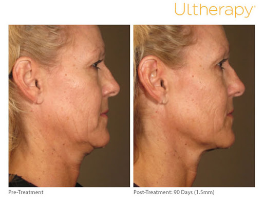 Medical Spa «Pur Skin Clinic», reviews and photos, 307 Bell St #104, Edmonds, WA 98020, USA