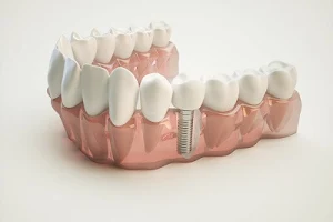 Gentle Dentist - Smile Spa image