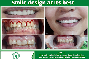 Shreeji Digital Dental Care - Dr.Reshma J Nilak image