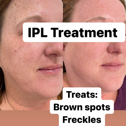 Explore fishnet tattoo ideas, creative tattoo ideas in Owensboro, available at The Skin Lab