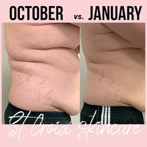 Explore halloween tattoo ideas for women, creative tattoo ideas in Hudson, available at St Croix Skincare