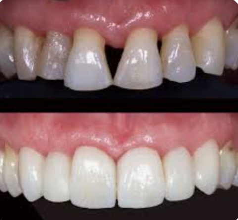 Clínica Dental y Medicina Estética AS en Vic, Barcelona