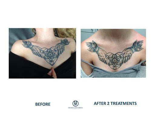 Explore 88 tattoo ideas, creative tattoo ideas in San Diego, available at Removery Tattoo Removal & Fading