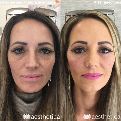 Explore rare breed tattoo ideas, creative tattoo ideas in Pleasant Grove, available at Aesthetica