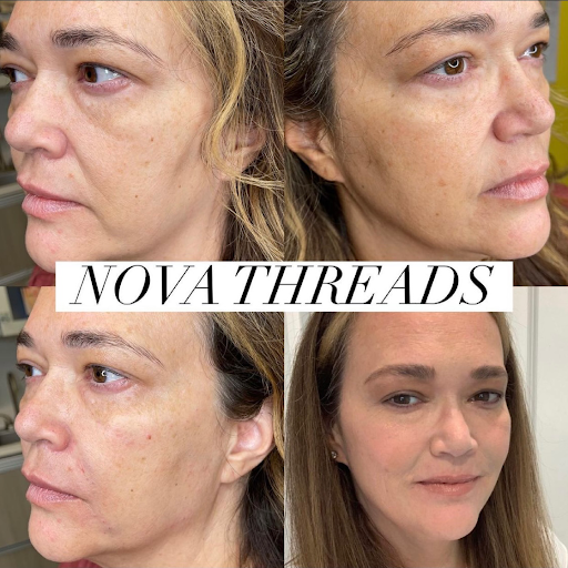Lifted Beauty Medical Practice image